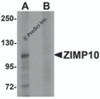 Western blot analysis of ZIMP10 in K562 cell lysate with ZIMP10 antibody at 0.5 &#956;g/mL in (A) the absence and (B) the presence of blocking peptide