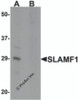 Western blot analysis of SLAMF1 in rat colon tissue lysate with SLAMF1 antibody at 1 &#956;g/mL in (A) the absence and (B) the presence of blocking peptide.