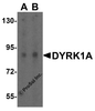 Western blot analysis of DYRK1A in HeLa cell lysate with DYRK1A antibody at (A) 1 and (B) 2 &#956;g/mL.