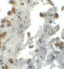 Immunohistochemistry of EZH1 in human lung tissue with EZH1 antibody at 5 ug/mL.