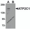 Western blot analysis of ATP2C1 in mouse brain tissue lysate with ATP2C1 antibody at 1 &#956;g/mL in (A) the absence and (B) the presence of blocking peptide.