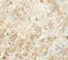 Immunohistochemistry of ATP2C1 in mouse brain tissue with ATP2C1 antibody at 5 ug/mL.