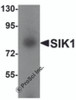 Western blot analysis of SIK1 in human small intestine tissue lysate with SIK1 antibody at 1 &#956;g/mL.