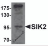 Western blot analysis of SIK2 in SW480 cell lysate with SIK2 antibody at 1 &#956;g/mL.