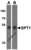 Western blot analysis of SPT1 in (A) A549 and (B) HeLa cell lysate with SPT1 antibody at 1 &#956;g/mL.