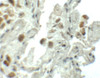 Immunohistochemistry of SPT1 in human lung tissue with SPT1 antibody at 5 ug/mL.