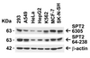 Figure 1 Independent Antibody Validation (IAV) via Protein Expression Profile in Human Cell Lines
Loading: 15 &#956;g of lysates per lane.
Antibodies: SPT2, 6305 (1 &#956;g/mL) , SPT2, 64-238 (1 &#956;g/mL) , and beta-actin (1 &#956;g/mL) , 1h incubation at RT in 5% NFDM/TBST.
Secondary: Goat anti-rabbit IgG HRP conjugate at 1:10000 dilution.