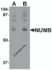 Western blot analysis of NUMB in mouse lung tissue lysate with NUMB antibody at (A) 0.25 and (B) 0.5 &#956;g/mL.