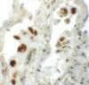 Immunohistochemistry of NUMB in human lung tissue with NUMB antibody at 5 ug/mL.