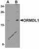 Western blot analysis of ORMDL1 in SK-N-SH Cell lysate with ORMDL1 antibody at (A) 1 &#956;g/mL and (B) 2 &#956;g/mL.