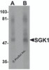 Western blot analysis of SGK1 in human stomach tissue lysate with SGK1 antibody at (A) 1 and (B) 2 &#956;g/mL.