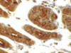 Immunohistochemistry of SGK1 in human stomach tissue with SGK1 antibody at 5 ug/mL.