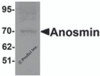 Western blot analysis of Anosmin in MCF7 cell lysate with Anosmin antibody at 1 &#956;g/mL.
