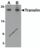 Western blot analysis of Translin in rat lung tissue lysate with Translin antibody at (A) 0.5 and (B) 1 &#956;g/mL