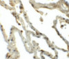 Immunohistochemistry of Translin in human lung tissue with Translin antibody at 5 ug/mL.