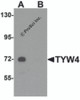 Western blot analysis of TYW4 in rat brain tissue lysate with TYW4 antibody at 1 &#956;g/mL in (A) the absence and (B) the presence of blocking peptide.