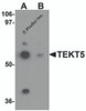 Western blot analysis of TEKT5 in 3T3 cell lysate with TEKT5 antibody at (A) 0.25 and (B) 0.5 &#956;g/mL.