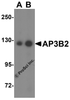 Western blot analysis of AP3B2 in rat brain tissue lysate with AP3B2 antibody at (A) 1 and (B) 2 &#956;g/mL.