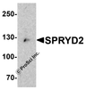 Western blot analysis of SPRYD2 in mouse heart tissue lysate with SPRYD2 antibody at 1 &#956;g/mL.