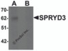 Western blot analysis of SPRYD3 in human brain tissue lysate with SPRYD3 antibody at 1 &#956;g/mL in (A) the absence and (B) the presence of blocking peptide