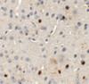 Immunohistochemistry of SPRYD3 in mouse brain tissue with SPRYD3 antibody at 5 ug/mL.