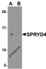 Western blot analysis of SPRYD4 in fetal human liver tissue lysate with SPRYD4 antibody at 1 &#956;g/mL in (A) the absence and (B) the presence of blocking peptide