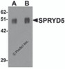 Western blot analysis of SPRYD5 in rat brain tissue lysate with SPRYD5 antibody at (A) 0.25 and (B) 0.5 &#956;g/mL .