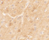 Immunohistochemistry of SPRYD5 in mouse brain tissue with SPRYD5 antibody at 5 ug/mL.