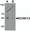 Western blot analysis of KCNK13 in rat brain tissue lysate with KCNK13 antibody at 0.5 &#956;g/mL in (A) the absence and (B) the presence of blocking peptide.