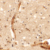 Immunohistochemistry of KCNK13 in human brain tissue with KCNK13 antibody at 5 ug/mL.