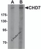 Western blot analysis of CHD7 in SK-N-SH cell lysate with CHD7 antibody at (A) 1 and (B) 2 &#956;g/mL.