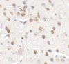 Immunohistochemistry of CHD7 in mouse brain tissue with CHD7 antibody at 5 ug/mL.