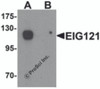 Western blot analysis of EIG121 in MCF7 cell lysate with EIG121 antibody at 1 &#956;g/mL in (A) the absence and (B) the presence of blocking peptide.