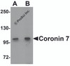 Western blot analysis of Coronin 7 in rat lung tissue lysate with Coronin 7 antibody at (A) 1 and (B) 2 &#956;g/mL.