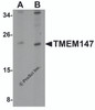 Western blot analysis of TMEM147 in Daudi cell lysate with TMEM147 antibody at (A) 1 and (B) 2 &#956;g/mL.