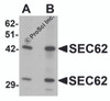 Western blot analysis of SEC62 in rat brain tissue lysate with SEC62 antibody at (A) 0.5 and (B) 1 &#956;g/mL.