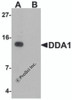 Western blot analysis of DDA1 in mouse heart tissue lysate with DDA1 antibody at 1 &#956;g/mL in (A) the absence and (B) the presence of blocking peptide