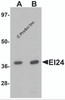 Western blot analysis of EI24 in rat liver tissue lysate with EI24 antibody at (A) 1 and (B) 2 &#956;g/mL.