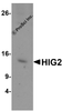 Western blot analysis of HIG2 in A549 cell lysate with HIG2 antibody at 1 &#956;g/mL.
