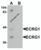 Western blot analysis of ECRG1 in mouse liver tissue lysate with ECRG1 antibody at 1 &#956;g/mL in (A) the absence and (B) the presence of blocking peptide.