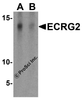 Western blot analysis of ECRG2 in A-20 cell lysate with ECRG2 antibody at 1 &#956;g/mL in the (A) absence and (B) presence of blocking peptide.