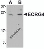 Western blot analysis of ECRG4 in HeLa cell lysate with ECRG4 antibody at (A) 1 and (B) 2 &#956;g/mL.