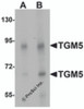 Western blot analysis of TGM5 in rat heart tissue lysate with TGM5 antibody at (A) 1 and (B) 2 &#956;g/mL.