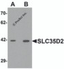 Western blot analysis of SLC35D2 in HeLa cell lysate with SLC35D2 antibody at (A) 1 and (B) 2 &#956;g/mL.
