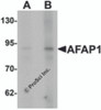 Western blot analysis of AFAP1 in Hela cell lysate with AFAP1 antibody at (A) 1 and (B) 2 &#956;g/mL.