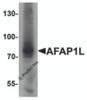 Western blot analysis of AFAP1L1 in A549 cell lysate with AFAP1L1 antibody at 1 &#956;g/mL.
