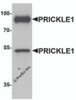 Western blot analysis of PRICKLE1 in human bladder tissue lysate with PRICKLE1 antibody at 1 &#956;g/mL.