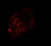 Immunofluorescence of PRICKLE1 in human bladder cells with PRICKLE1 antibody at 20 ug/mL.