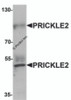 Western blot analysis of PRICKLE2 in A-20 lysate with PRICKLE2 antibody at 1 &#956;g/mL.