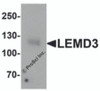 Western blot analysis of LEMD3 in human colon tissue lysate with LEMD3 antibody at 1 &#956;g/mL.